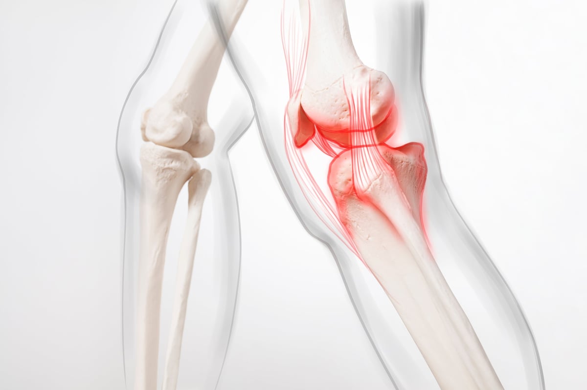 Video thumbnail showing joint health content